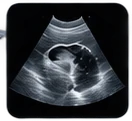 Illustrative ultrasound scan