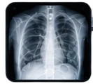 Illustrative chest X-ray scan